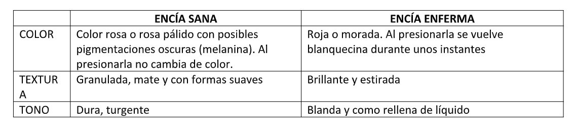 sangran-encías-ibiza-tabla